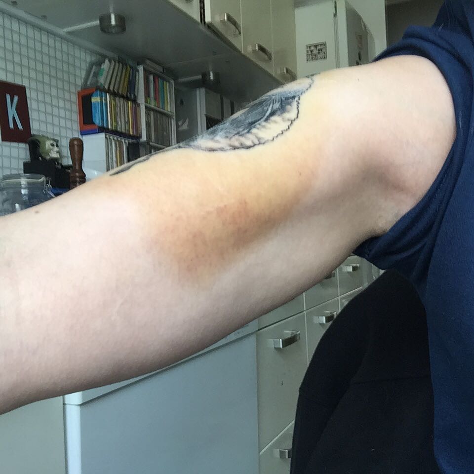 Tattoo Bruising: Causes & Treatment 10 Tattoo Bruise