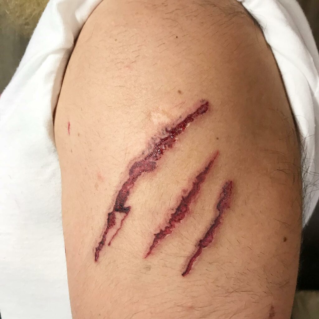Tattoo Bleeding: What To Look For & How To Fix It! 12 Tattoo Bleeding