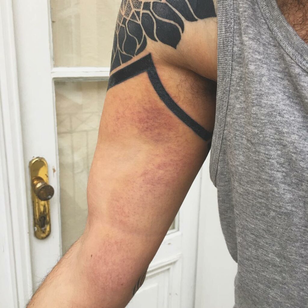 Tattoo Bruising: Causes & Treatment 14 Tattoo Bruise