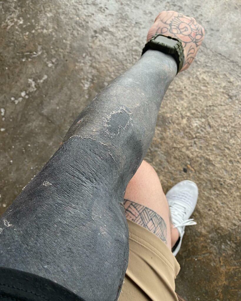 My Tattoo is Peeling - 3 Key Things To Understand! 12 My Tattoo is Peeling