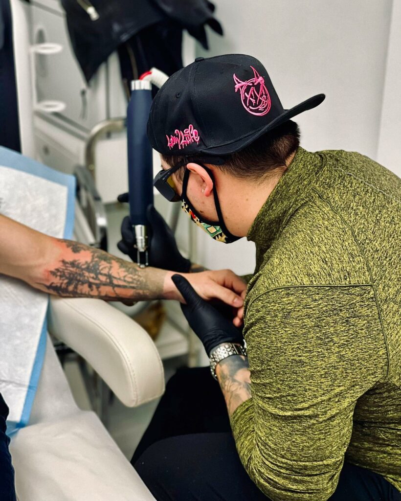 Best Laser Tattoo Removal Machines - Updated For 2024 14 Tattoo Removal