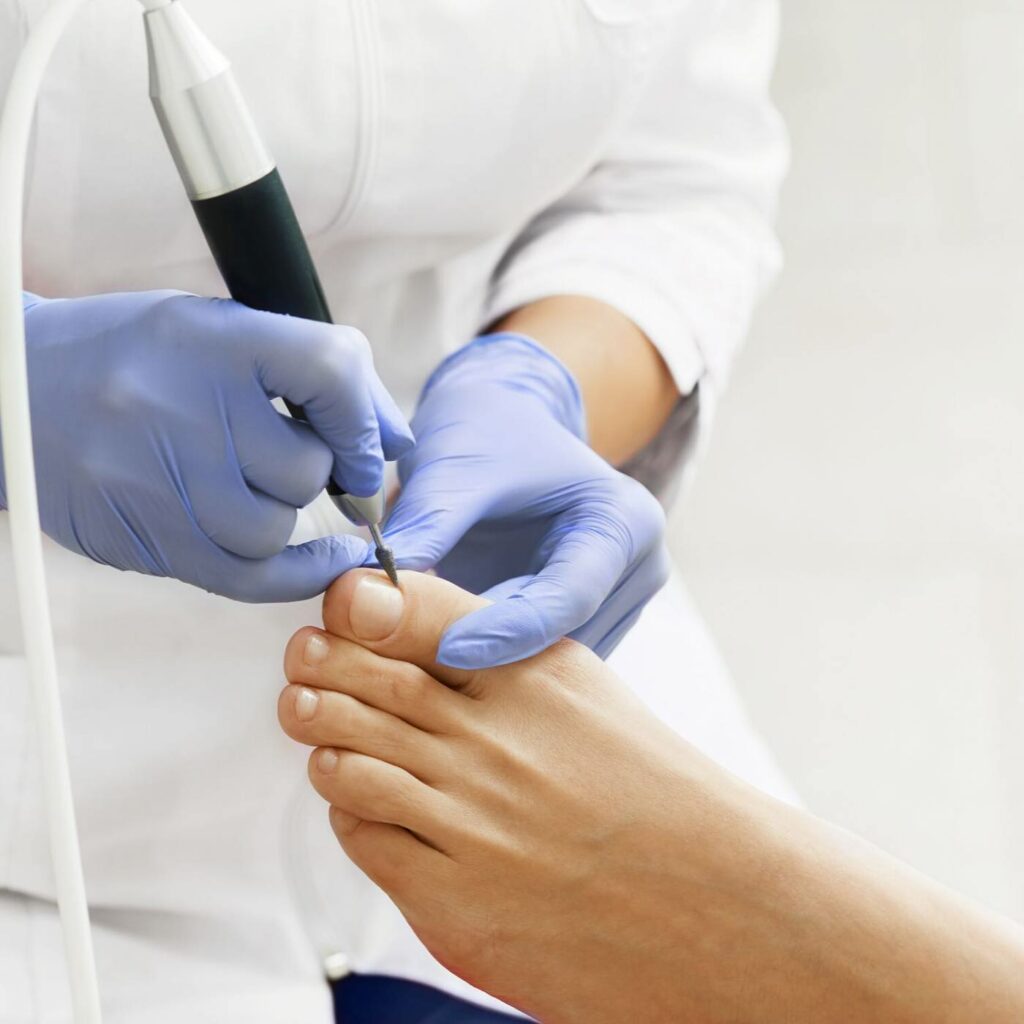 Revitalize Your Feet: Unraveling the Secrets of Medical Pedicure in 2024 14 Medical Pedicure