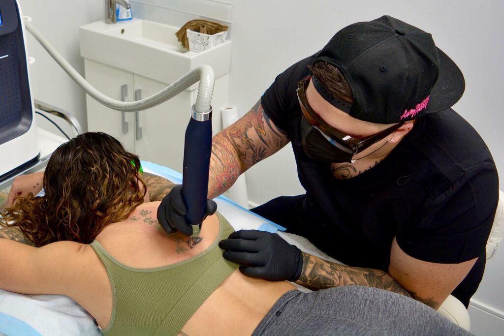 Best Laser Tattoo Removal Machines - Updated For 2024 13 Tattoo Removal