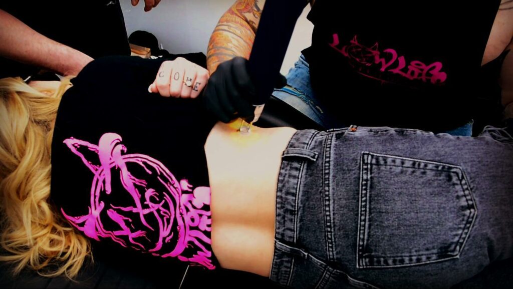 Best Laser Tattoo Removal Machines - Updated For 2024 15 Tattoo Removal