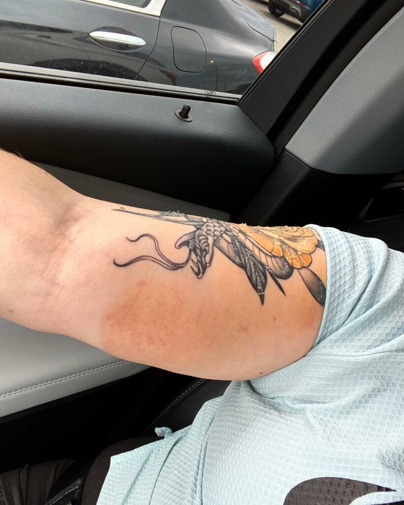 Tattoo Bruising: Causes & Treatment 11 Tattoo Bruise