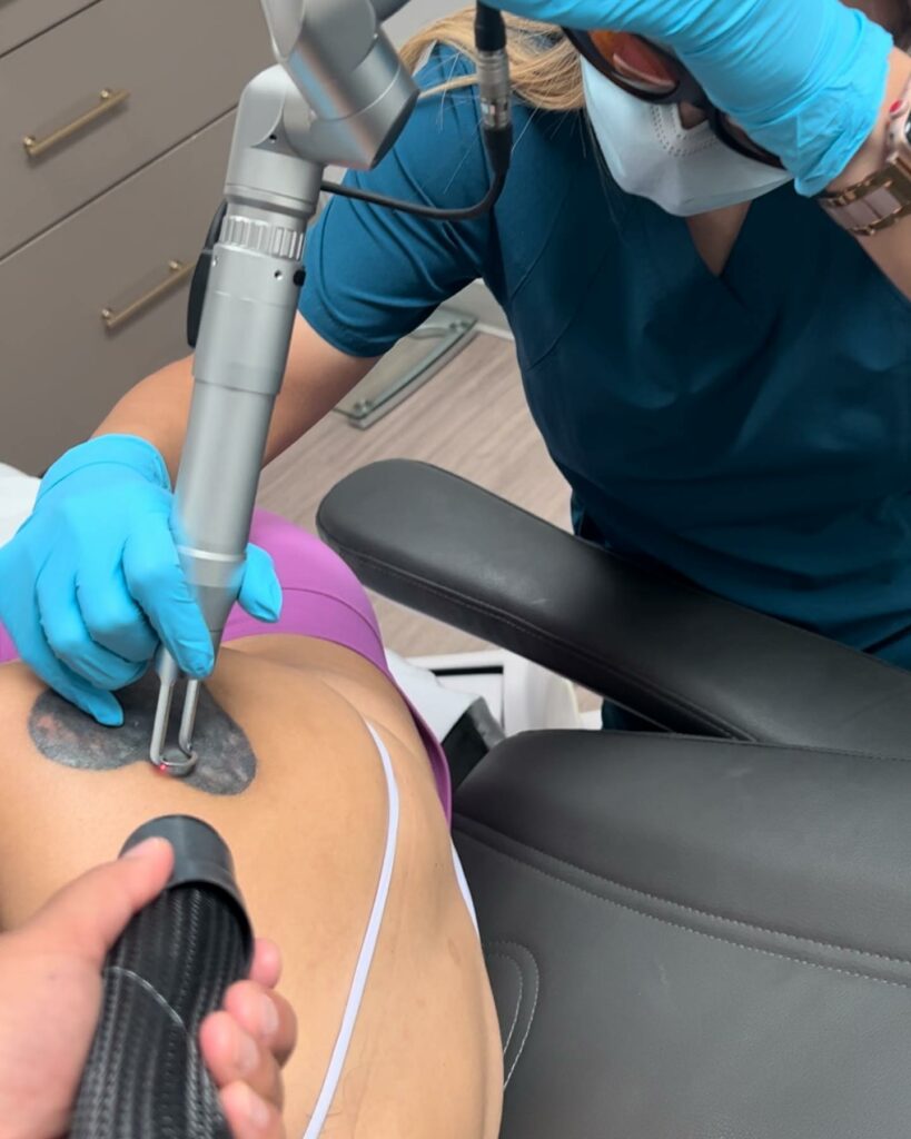Laser Tattoo Removal vs Saline Tattoo Removal - Everything You Need To Know & More In 2024 15 Tattoo Removal