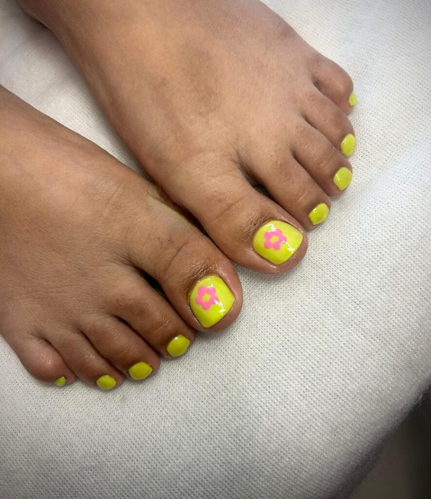 20 Latest Neon Yellow Pedicure Ideas To Try In 2024! 19 Neon Yellow Pedicure with Flower Power