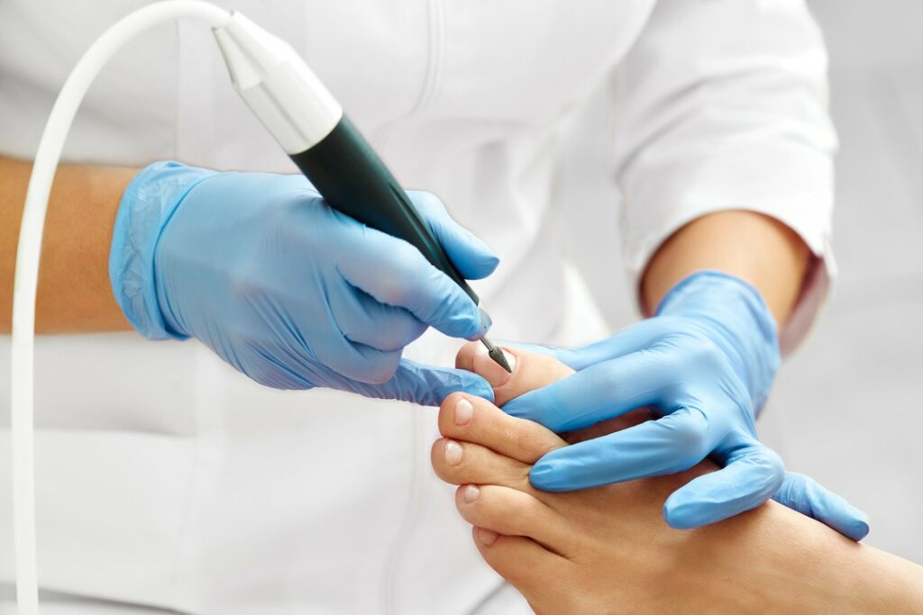 Revitalize Your Feet: Unraveling the Secrets of Medical Pedicure in 2024 16 Medical Pedicure