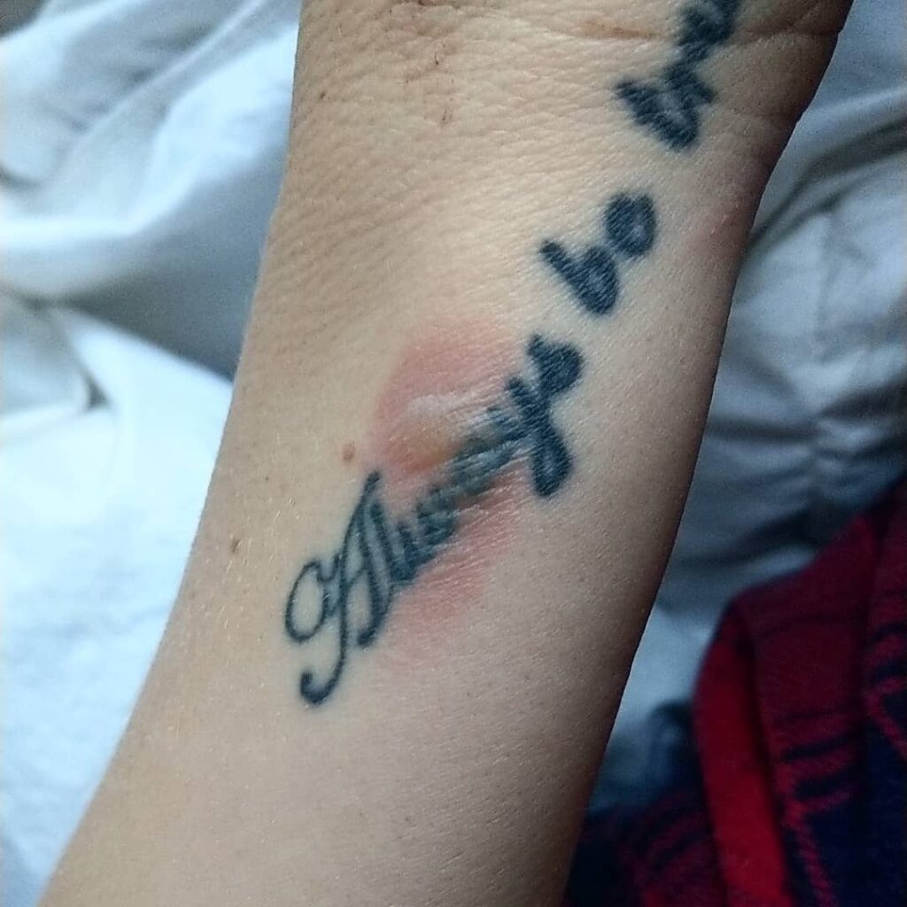 How To Stop Your New Tattoo Burning - 3 Simple Steps 11 Tattoo Burn