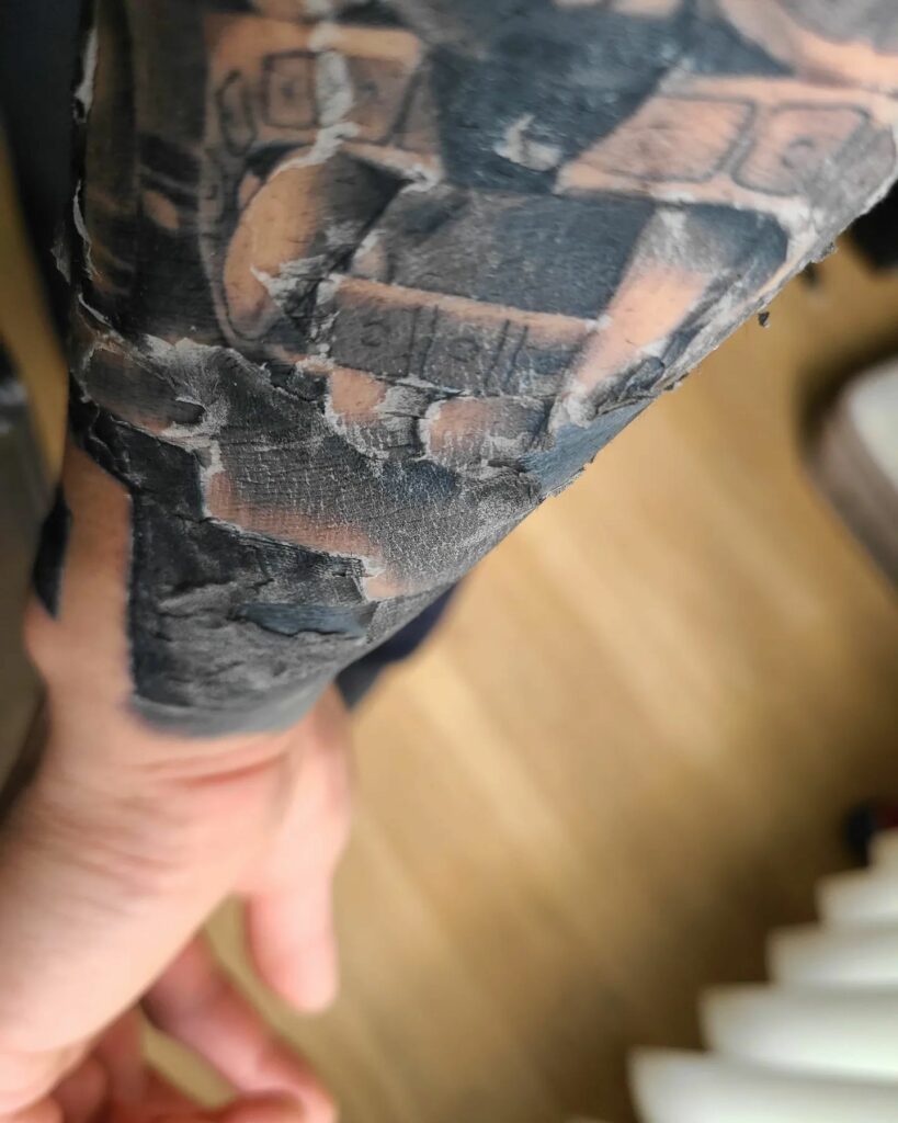 My Tattoo is Peeling - 3 Key Things To Understand! 11 My Tattoo is Peeling