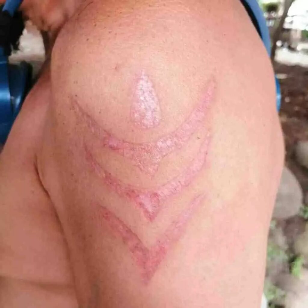 Why Is My Tattoo Fading After 3 Days - Get The Facts In 2024 12 Tattoo Fade