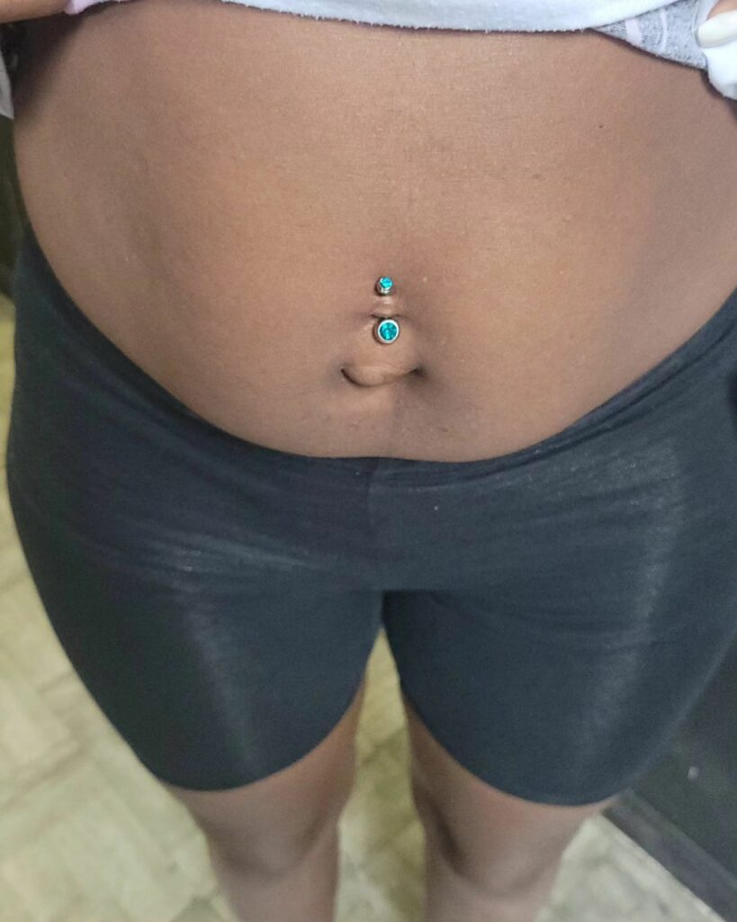 Belly Button Piercing Scars 11 Belly piercing scars