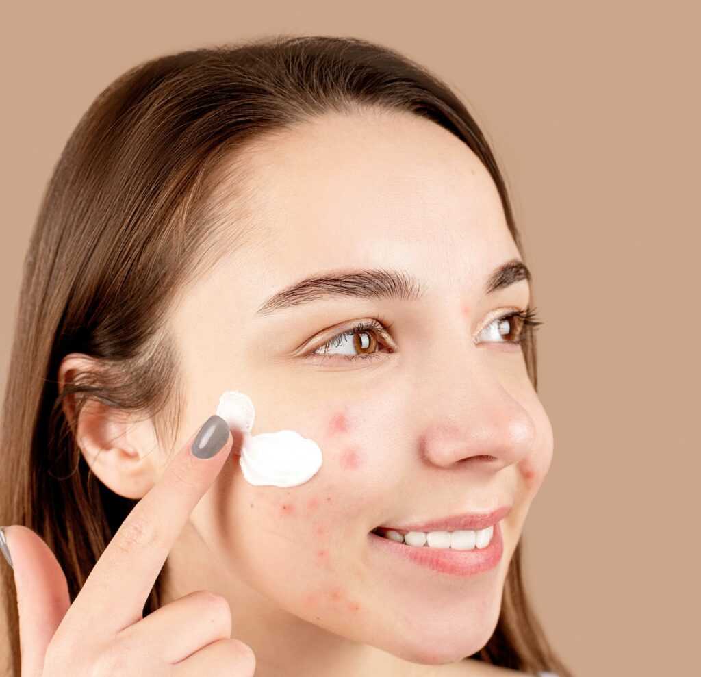 Does CeraVe Cause Skin Breakouts - Unraveling the Truth In 2024 13 CeraVe for Acne-Prone Skin