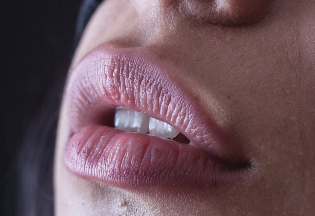Unraveling the Mystery: Why Do My Lips Appear, Fuller, Each Morning 13 How To Make Lips Look Bigger