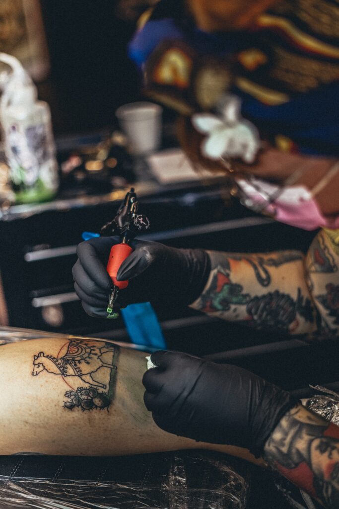How To Remove A Stick and Poke Tattoo in 2024 13 Get Rid of a Stick and Poke Tattoo